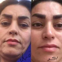 کرم بیوممتیک+ جوانساز دائمی