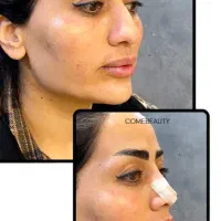 فشیال پاکسازی پی آر پی هایفو لاغری کربن زگیل