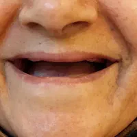 دندانسازی