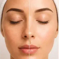 فیشال وپاکسازی صورت