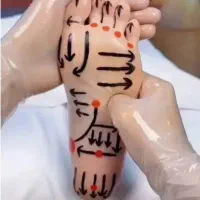 رگ گیری،طب سوزنی،حجامت،ماساژ
