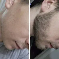 بازگشت اعتماد به نفس تضمینی