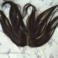 پروتز مویی جلویه سر با مویه طبیعی