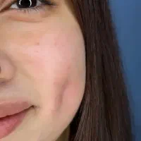 چال لپ و پیرسینگ