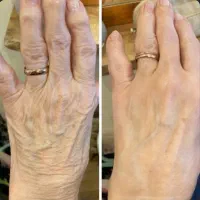 کرم بیوممتیک شفاف کننده و ضد لک و سفید کننده