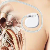 پیس میکر مایکرا دو حفره ای