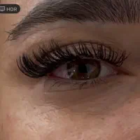 کاشت و اکسیشن مژه