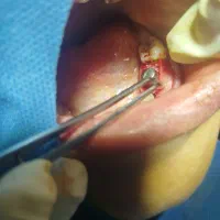 استخدام دستیار دندانپزشک