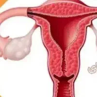 مشاوره اولیه مامایی