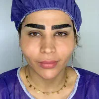 مدل کاشت ابرو
