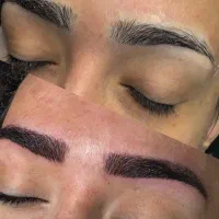 میکرو فیبروز همه چی تمام