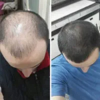 موهات داره بهت هشدار میده