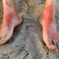 محافظ رادیات بخاری ۲۰۶و ۲۰۷
