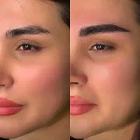 میکروبلیدینگ با هزینه مواد