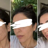 جوانساز طبیعی با ارسال رایگان