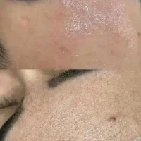 تخفیف خدمات زیبایی سه شنبه ها کوتاهی رایگان
