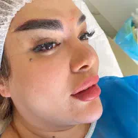 کاشت ابرو تضمینی با تراکم عالی