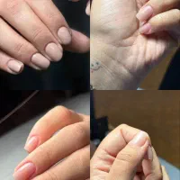 جذب مدل ناخن .کاشت و ترمیم