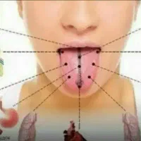سنوگرافی با عکس زبان