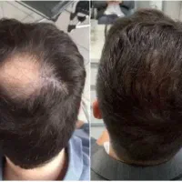 باما خیالتون از سلامت موی سرتون راحت هست