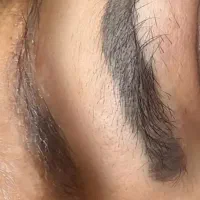 ریمووتخصصی تتوهای قدیمی فقط با۵۰۰هزارتومن