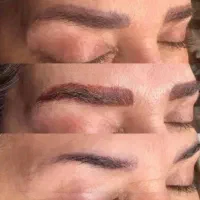 ریموو ابرو تک جلسه ای تضمینی