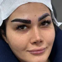 استخدام بازاریاب کاشت ابرو بابل
