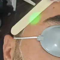 جشنواره تخفیفی لیزر دکا