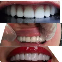 خدمات دندانپزشکی و دندانسازی مستر دنت (اقساط)