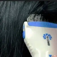 پاک سازی سر با دستگاه رشک و شپش و مژه موقت