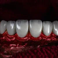 پذیرش دندانپزشکی