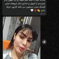 کاشت ابرو۹میلیون مدل۶میلیون اموزش کاشت ابرو-کات