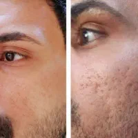 محصولات آرایشی و مراقبتی