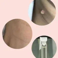زگ. یل|آرایشی، بهداشتی، درمانی|جعفرآباد, |دیوار