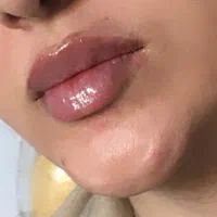 همکاری با کلینیک و مراکز وسالن زیبایی