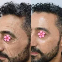 کرم بیوممتیک ۱۲کاره برای لیفت پوست و جوانسازی
