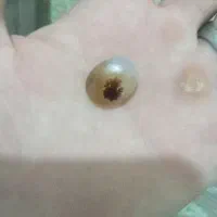سنگ شجر قائن