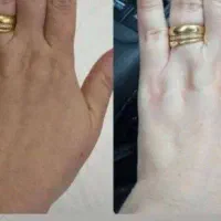 کاملا. گیاهی
