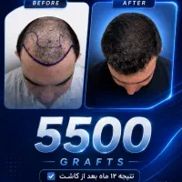 پر تراکم ترین در ایران/جشنواره 50 درصدی اِمو