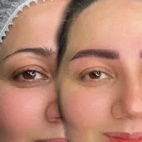 فیبروز ومیکرو پیگمنتیشن ابرو