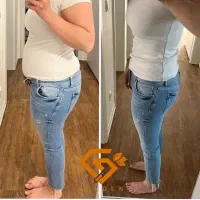 پیکرتراشی بدون جراحی با دستگاه غول لاغری