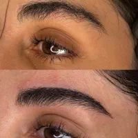 مدل فیبروز و میکروبلیدینگ رایگان