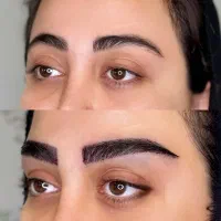 کاشت ابرو پر تراکم روسی