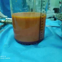 ابدومینوپلاستی لیپوساکشن پیکرتراشی ماموپلاستی