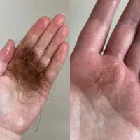 موهاتون رو تراپی کن