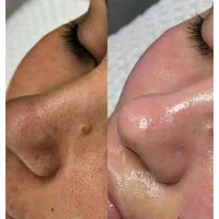 نیازمند مدل پاکسازی فقد هزینه متریال گرفته میشه