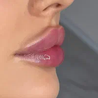 ژل بوتاکس فیلر زاویه سازی خط لبخند لیزر مطب پزشک