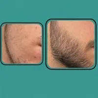 خدمات ویژه فرم دهی صورت