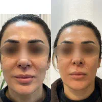 جشنواره کلینیک‌ زیبایی ونوس