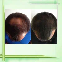 موهای سرتو با من پرپشت کن